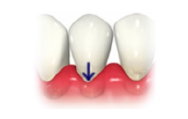 歯が伸びたような気がする