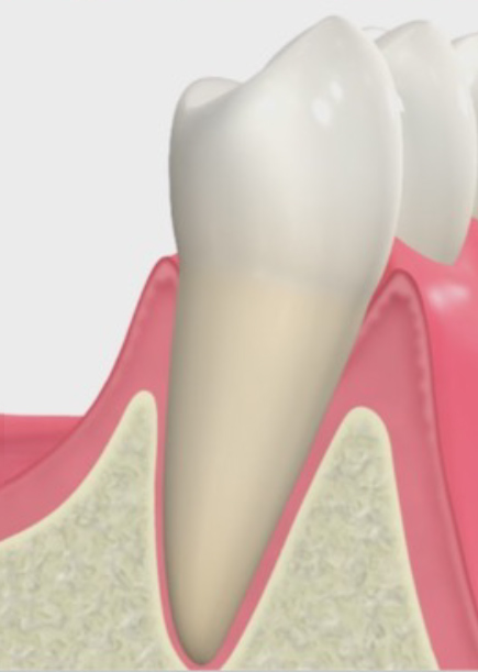無痛治療への取り組み
