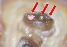 マイクロスコープ